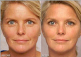 Re-tinol Face Gel 0.1 (20 gm) image 8