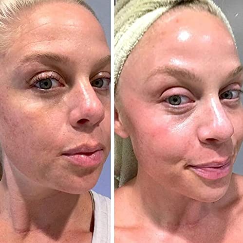 Re-tinol Face Gel 0.1 (20 gm) image 4