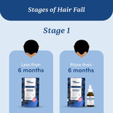 Man Matters Advanced Hair Serum 30ml image 4