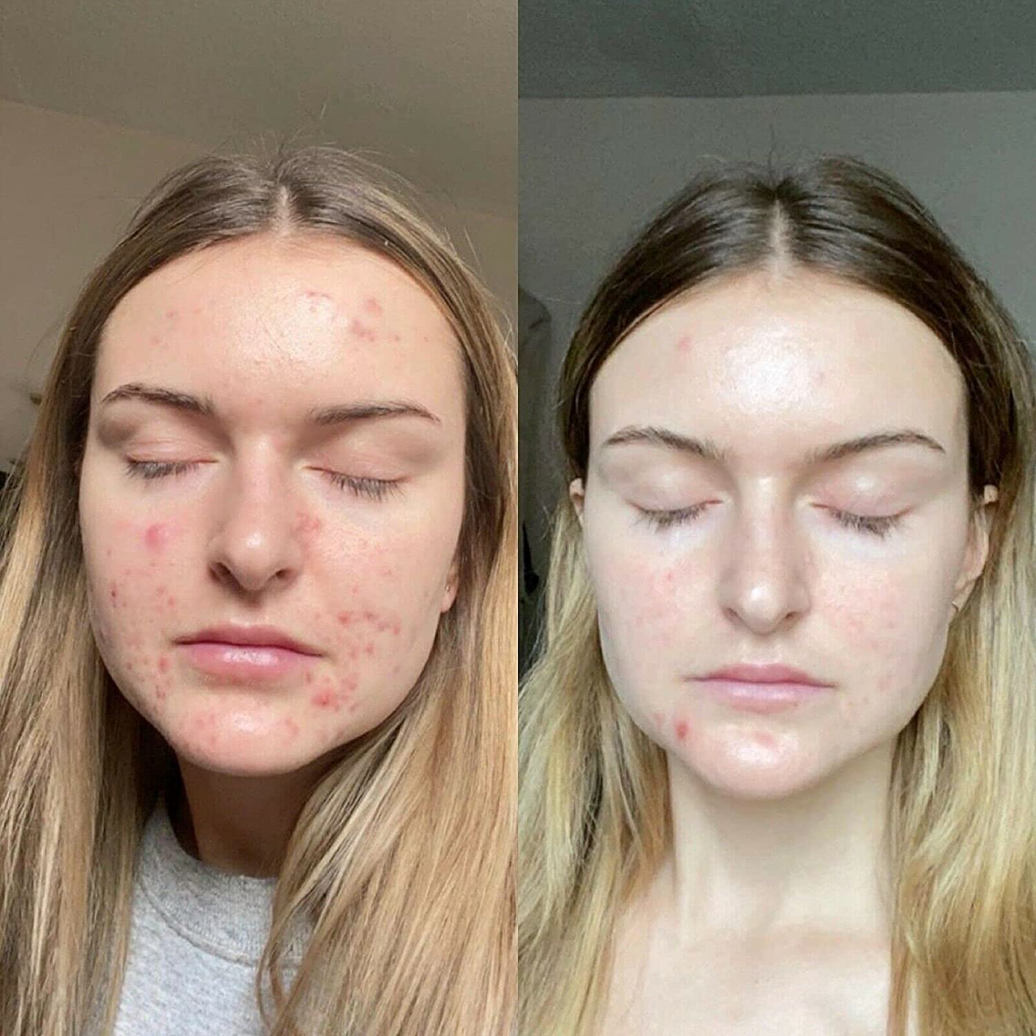 Re-tinol Face Gel 0.1 (20 gm) image 5