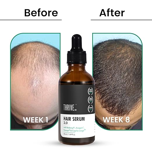 ThriveCo Hair Growth Serum 2.0 For Men & Women - 50 ml image 4