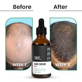 ThriveCo Hair Growth Serum 2.0 For Men & Women - 50 ml image 4