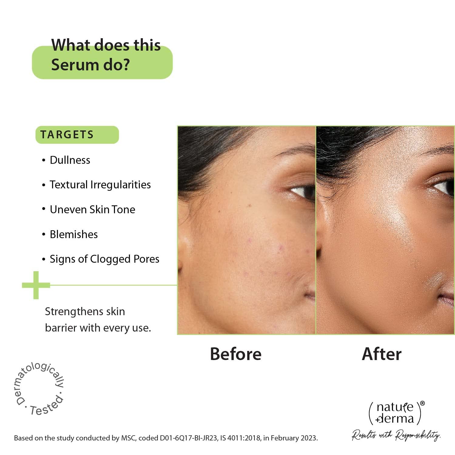 Nature Derma 10% Vitamin C Serum -10 ml image 3