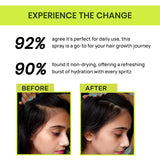 Alps Goodness Rosemary Rosemary Water Spray (200ml), Rosemary Water Spray (200ml), ...... Hair Essentials Pack image 6