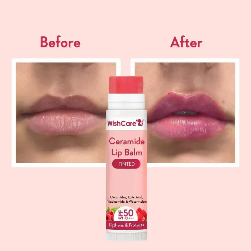 WishCare SPF 50 Lip Balm - Hydrating & Tinted Lip Care - 5g image 2