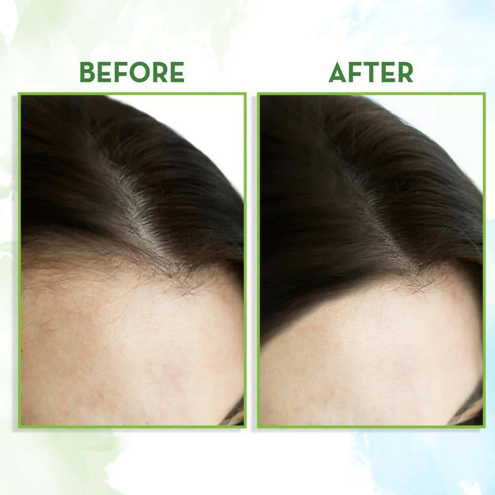 Mamaearth Rosemary Hair Growth Oil with Rosemary & Methi Dana -150 ml image 4