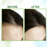 Mamaearth Rosemary Hair Growth Oil with Rosemary & Methi Dana -150 ml image 4
