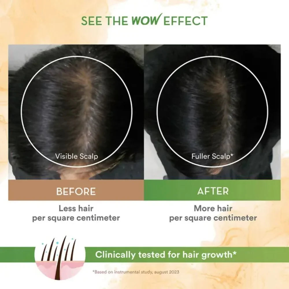 Wow Life Science Rosemary With Biotin Hair Serum -50 ml image 3