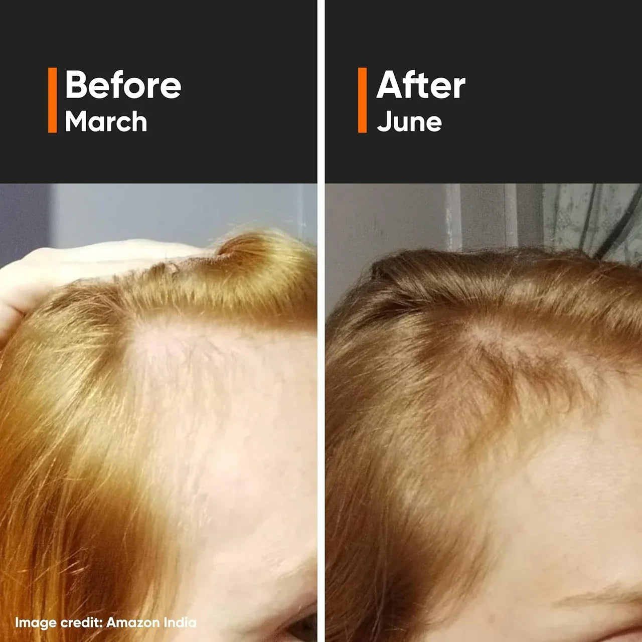 Minimalist Hair Growth Actives  -30 ml image 2