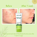 2% Salicylic Acid Face Wash - 100ml image 4